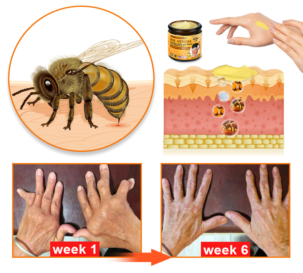 Furzero™🧊 Bee Venom & Turmeric Joint and Bone Pain Relief Cream (Specializes in Joint and Arthritis Pain & AAOS Recommends)