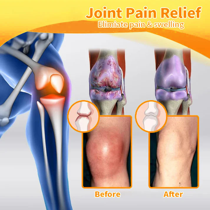 Furzero™🧊 Bee Venom & Turmeric Joint and Bone Pain Relief Cream (Specializes in Joint and Arthritis Pain & AAOS Recommends)