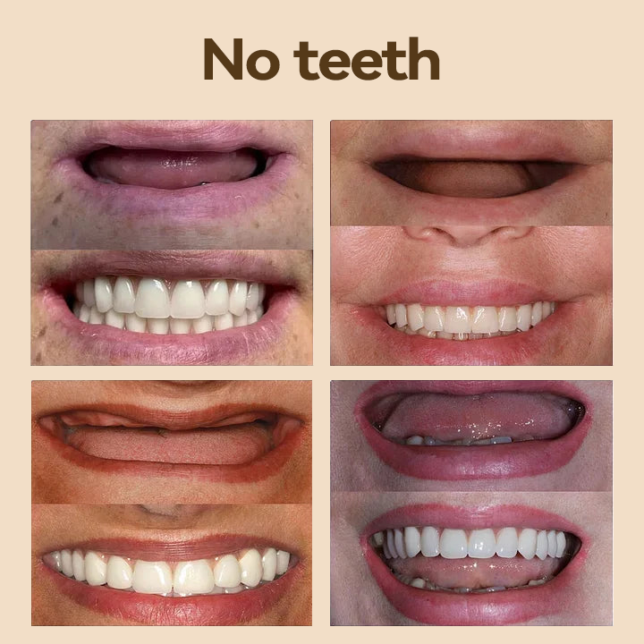 𝐇𝐢𝐝𝐨𝐧𝐞® 💎- 𝐏𝐫𝐞𝐦𝐢𝐮𝐦 𝐃𝐞𝐧𝐭𝐮𝐫𝐞- (✨Suitable for all mouth shapes, custom-made dentures for a perfect fit✨)
