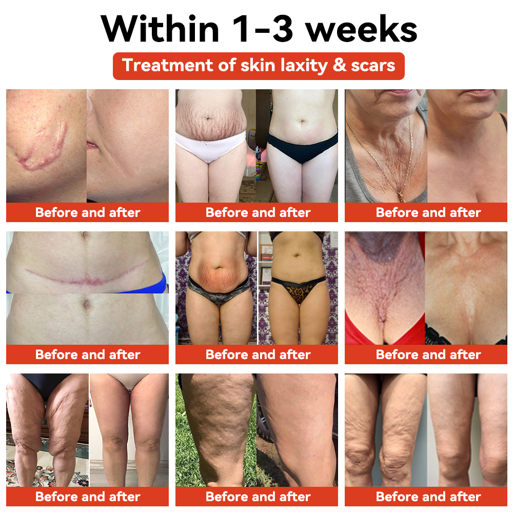 𝗦𝗧𝗗𝗘𝗜™🌈 𝗠𝗔𝗚𝗜𝗖 𝗟𝗨𝗫𝗨𝗥𝗬 𝗕𝗢𝗗𝗬 𝗢𝗜𝗟 (Limited Time 80% Off - Last 30 Minutes)