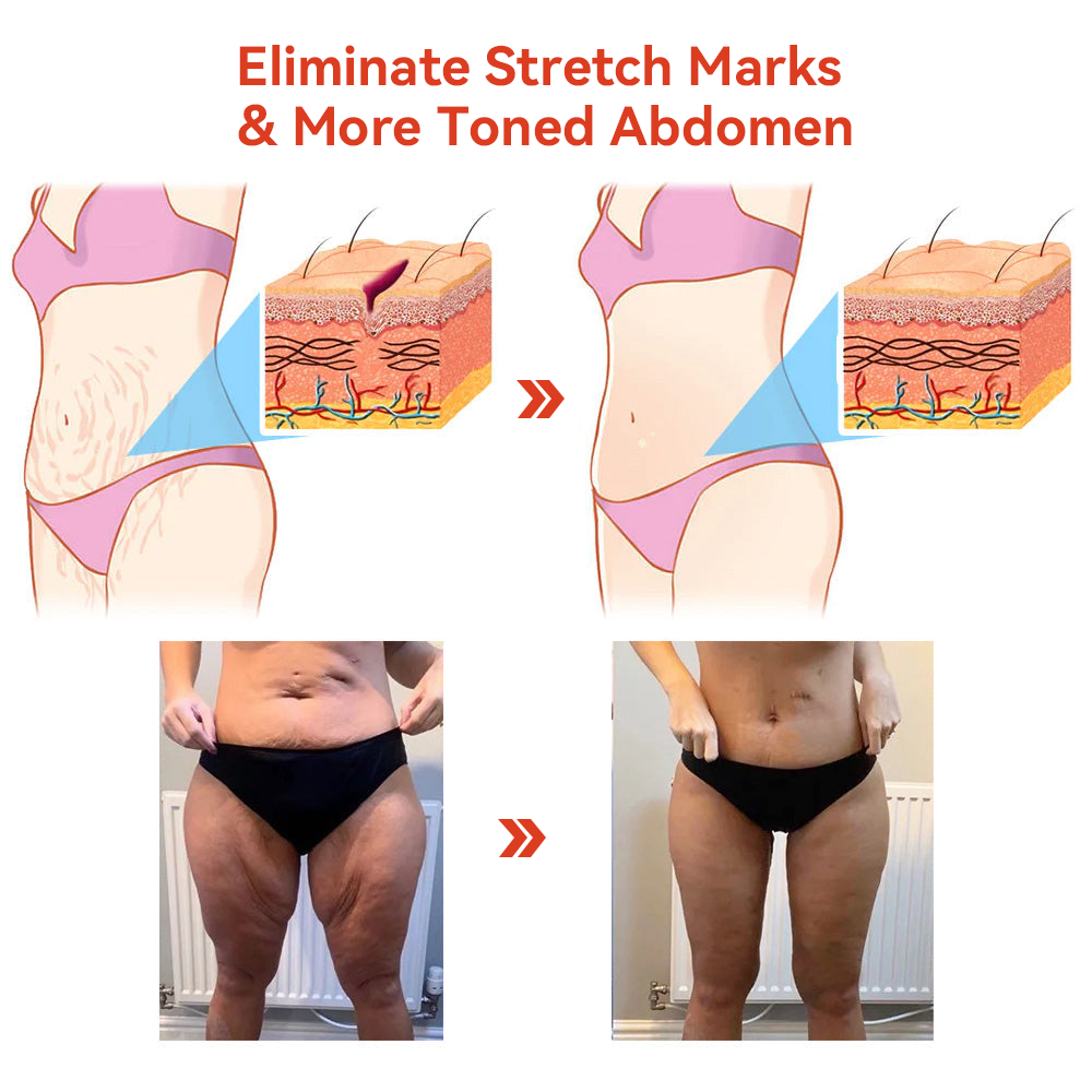 𝗦𝗧𝗗𝗘𝗜™🌈 𝗠𝗔𝗚𝗜𝗖 𝗟𝗨𝗫𝗨𝗥𝗬 𝗕𝗢𝗗𝗬 𝗢𝗜𝗟 (Limited Time 80% Off - Last 30 Minutes)
