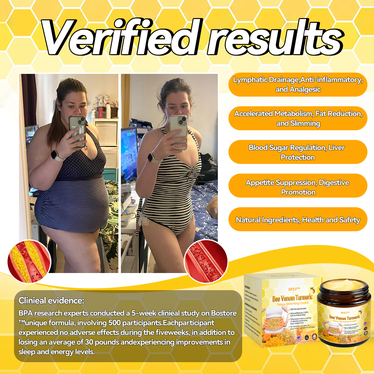 SPZV™ Bee Venom Turmeric Detox Slimming Cream🦄（For all obesity and lymphatic problems）