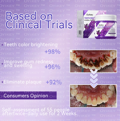 Oyikey™🍀 TOOTH RESTORATION MINERAL POWDER(BDA recommended)