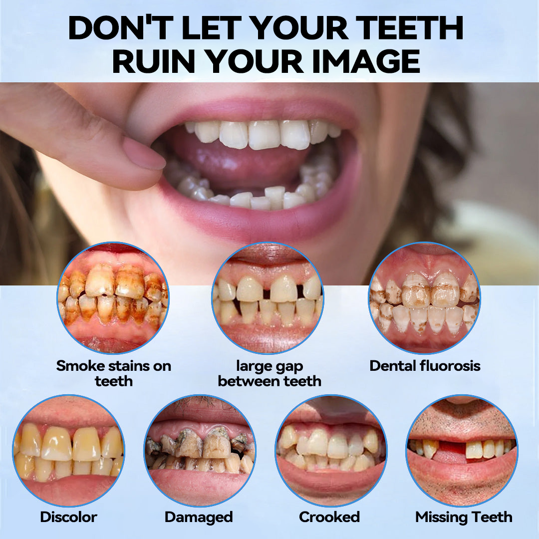 𝐁𝐢𝐤𝐞𝐧𝐝𝐚™💎 Silicone Reline Denture Set (⏰ Limited Time Discount Last 30 Minutes ⏰)