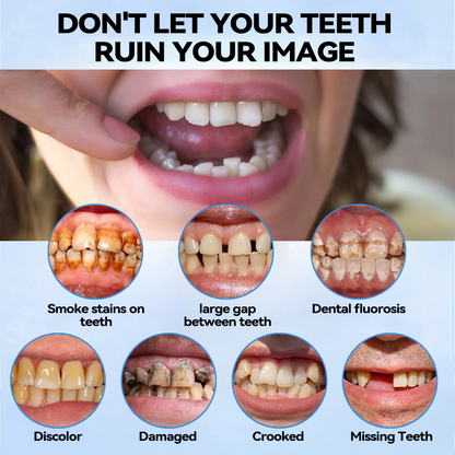 𝐁𝐢𝐤𝐞𝐧𝐝𝐚™💎 Silicone Reline Denture Set (⏰ Limited Time Discount Last 30 Minutes ⏰)